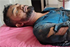 Puttur: Two-wheeler rider seriously injured in wild boar attack
